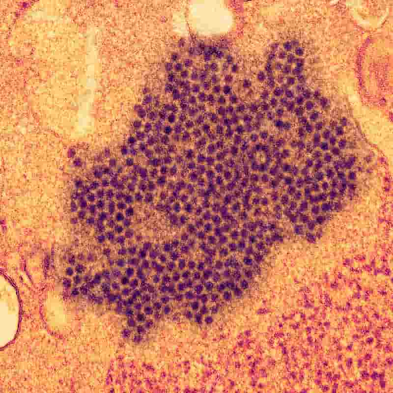 Enterovirus
